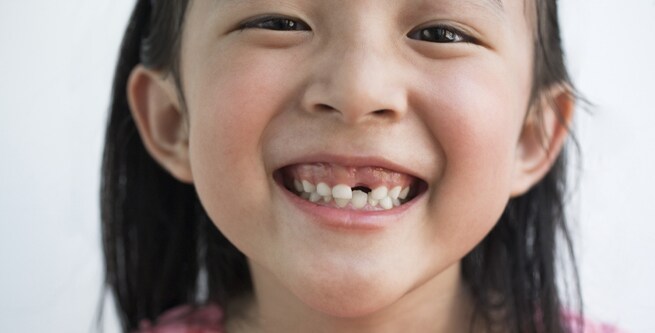 Young girl smiling wide while looking directly into the camera with a missing front tooth
