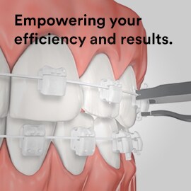 Video explaining the functions and recent advances of Clarity Ultra Self-Ligating brackets.