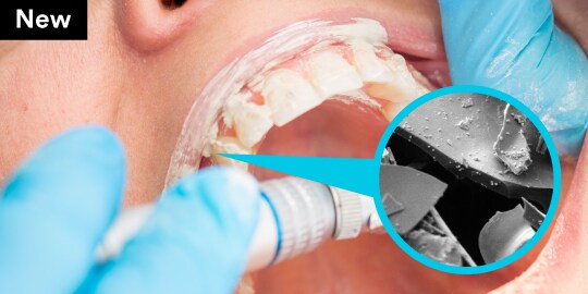 Perlite particle before dental prophylaxis
