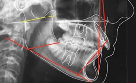 Initial tracing in Stradi case study