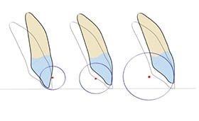 relation between arch, center of resistance and center of rotation change of the tooth position.