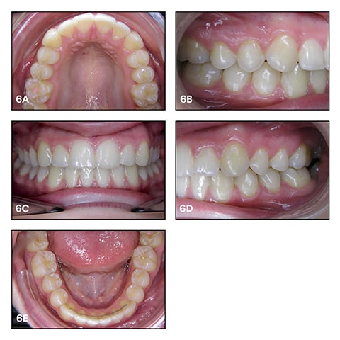 Images taken during a check-up in October 2017 revealing a successful treatment with stable outcomes.