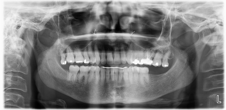Figure 4J: Dental Panorex