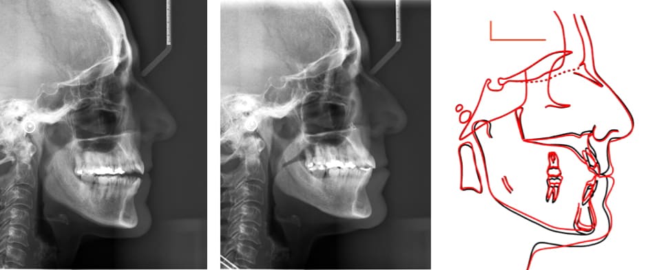 Table 5&rsquo;: General structural superimposition
