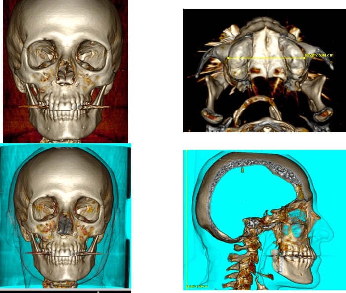 Table 5&rsquo;&rsquo;: Images of 3D scanner